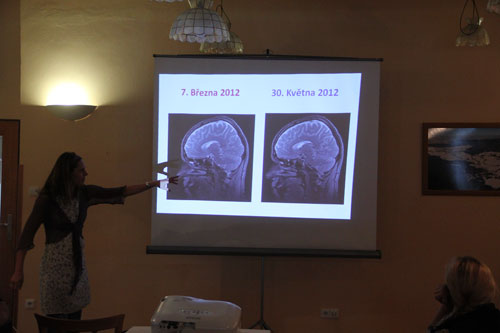 MRI před expedicí a po expedici – rozdíl žádný!